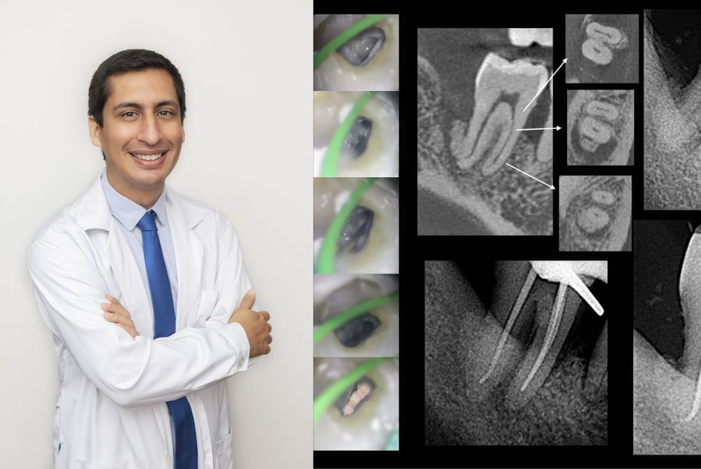 Centro dental para Terapia Pulpar Vital